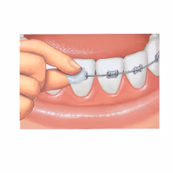 GUM 6056792 orthodontic wax 1 pc(s)