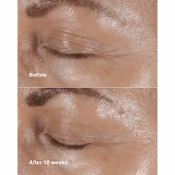 Clinique Smart Clinical Repair Wrinkle Correcting Eye Cream 15 ml - Additional view 4