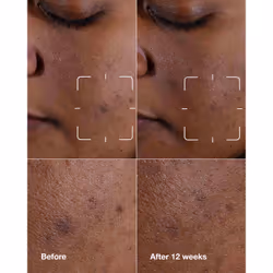 Clinique Even Better Clinical Dark Spot Clearing Serum 30ml - Additional view 2
