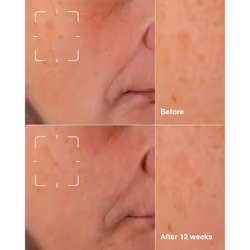 Clinique Even Better Clinical Dark Spot Clearing Serum 30ml - Additional view 3