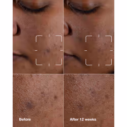 Clinique Even Better Clinical Dark Spot Clearing Serum 50ml - Additional view 2