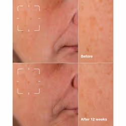 Clinique Even Better Clinical Dark Spot Clearing Serum 50ml - Additional view 3
