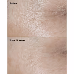 Clinique Smart Clinical Repair Broad Spectrum SPF 30 Wrinkle Correcting Cream 50 ml - Additional view 4