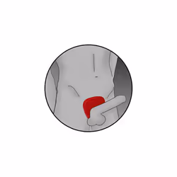 ElectraStim Silicone Fusion Viper Cock Shield