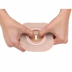 New Image FormaFlex Moldable  Extended Wear Ostomy Barrier Adhesive Ta