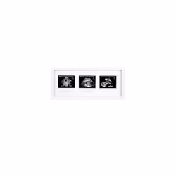 Trimester Sonogram Picture Frame, Pregnancy Photo Milestone Wall Decor, Ultrasound Keepsake, Gender-Neutral Baby Nursery Déc ...