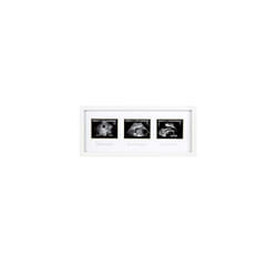 Trimester Sonogram Picture Frame, Pregnancy Photo Milestone Wall Decor, Ultrasound Keepsake, Gender-Neutral Baby Nursery DÃ©cor, White