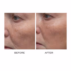 Elemis Peptide4 Thousand Flower Mask - 75 ml | Revitalising Face Mask