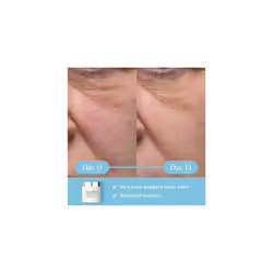 Dynamic Resurfacing Facial Pads, Exfoliating Face Pads with Tri-Enzyme Technology, Face Exfoliator to Smooth & Resurface, Gentle Exfoliating Pads to