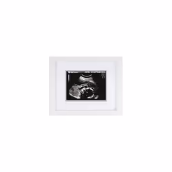 Sonogram Keepsake Frame, Mothering Sunday Mother's Day Expecting or New Mum Gift, White