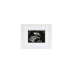 Sonogram Keepsake Frame, Mothering Sunday Mother's Day Expecting or New Mum Gift, White