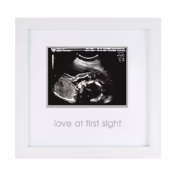 Pearhead Love at First Sight Sonogram Picture Frame  Pregnancy Ultraso