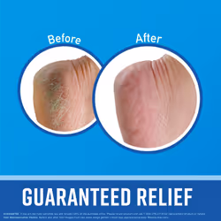 O'Keeffe's for Healthy Feet Foot Cream  Guaranteed Relief for Extremely Dry  Cracked Feet  Instantly Boosts Moisture Levels  3.2 Ounce Jar  Pack of 3