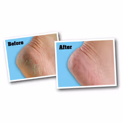 O'Keeffe's For Healthy Feet Foot Cream-3oz