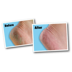 O'Keeffe's For Healthy Feet Foot Cream-3oz