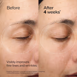 Shiseido Future Solution LX Eye and Lip Contour Regenerating Cream Refill - 17 mL - Visibly Improves the Look of Wrinkles & Sagging Around the Eyes an
