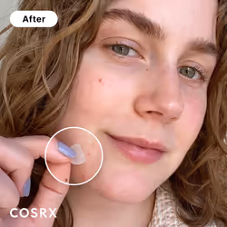 COSRX Acne Pimple Patch Absorbing Hydrocolloid Original 3 Size Patches for Blemishes and Zits Cover  Spot Stickers for Face and Body  Not Tested on An