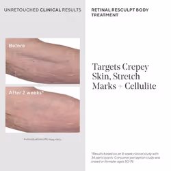 Retinal ReSculpt Body Treatment - Retinal Body Cream to Target Cellulite and Stretch Marks - Lifts  Firms  and Tightens Sagging  Crepey Skin  5.0 Fl O
