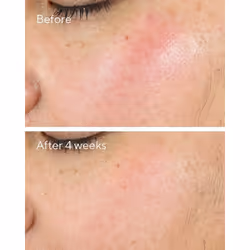Murad Intense Recovery Cream 50 ml - Additional view 4