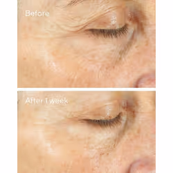 Murad Intense Recovery Cream 50 ml - Additional view 5