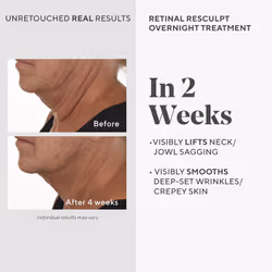 Murad Retinal ReSculpt Overnight Treatment - Resurgence Anti-Aging Serum for Lines and Wrinkles - Encapsulated Vitamin A Skin Care for Smoothing  Firm