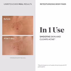 Murad Acne Retexturizing Face & Body Pads - Smooth + Soothe - with Azelaic + Bacteria-Targeting Multi-Acids to Soothe Irritation  Redness  and Providi