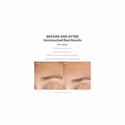 Murad Resurgence Replenishing Multi-Acid Peel - AHA / BHA Salicylic and Glycolic Acid Peel - Skin Renewing Face Peel - Daily Facial Peel Skin Care Tre