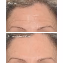 Murad Targeted Wrinkle Corrector 15ml - Additional view 4