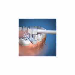 Waterpik Dental Water Jet Toothbrush Replacement Tips (Pack of 2)
