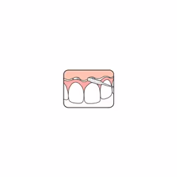Tepe Bridge & Implant Floss