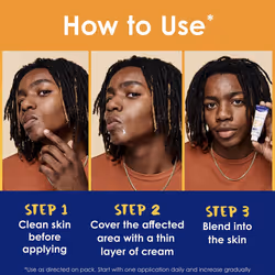 Clearasil Stubborn Acne Control 5in1 Spot Treatment Cream, Maximum Str