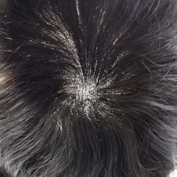 Toupee For Men Hair Piece European Human Hair Mens Toupee Injected PU Hair Replacement System Natural Hairline Gray Hair Pieces For Men(8x10''-120% Me