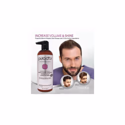 PURA D'OR Apple Cider Vinegar Thin2Thick Conditioner - With Biotin, Keratin, Caffeine, Castor Oil & Key Active Ingredients - For All Hair Types, Men a