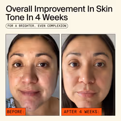 Youth To The People 15% Vitamin C Face Serum - Skin Firming Caffeine Serum for Morning Puffiness + Even Skin Tone - Brightening  Hydrating Facial Seru