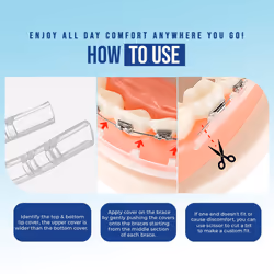 Comfort Cover Braces Guard/Lip and Mouth Protector - Snap on Cover Strip for Braces - Orthodontic/Dental Quality (Clear)