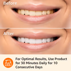 Amazon Basics 10 Day Teeth Whitening Strips Kit  10 Treatments  1-Pack (Previously Solimo)