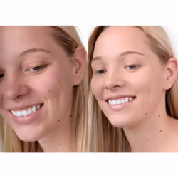 The Good Mineral Loves-You-Back 3in1 Mineral Powder Foundation (BEIGE 1) | Designed for Rosacea  Acne-Prone  Sensitive Skin | 3IN1 Concealer  Powder +