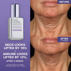 Estée Lauder Perfectionist Pro Rapid Firm + Lift Serum with Hexapeptides 8 + 9 30ml