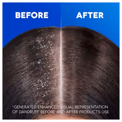 Head & Shoulders Classic Clean Dandruff Shampoo, Pack of 6 ( 6 x 250 ml), Clinically Proven Deep Clean, UK #1 Shampoo