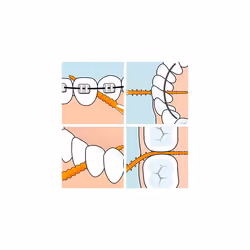 TEPE Easypick Dental Picks, Size Xs/S, Orange, Pacl of 36 (Pack of 3)