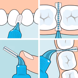 TePe Interdental Brush, Original, Yellow, 0.7mm/ISO 4, 20pcs, efficient Cleaning Between Teeth, Plaque Remover and Dental flosser for Small Gaps