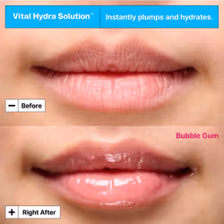 Dr.Jart+ Vital Hydra Solution Hydrating Lip Mask Bubble Gum 17g - Additional view 2