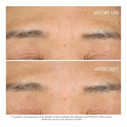 Dior Capture Totale Hyalushot 15ml - Additional view 4