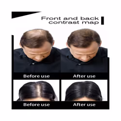 Authentic Keratin Hair Fibers Spray 27.5g Colorful Powder Hair Loss Building Hairline Optimizer Dense Hair Growth Black Brown - Dark Brown