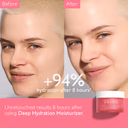VinoHydra Deep Hydration Moisturizer with Hyaluronic Acid - 50 mL - Amazon Exclusive