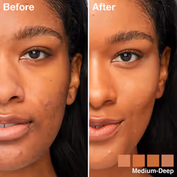 Instant Perfector Glow Multipurpose #03-medium-deep - Additional view 4