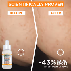 Garnier Vit C Anti-Dark Spot Serum 30ml