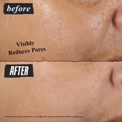Kiehl's Rare Earth Deep Pore Cleansing Mask  Pore-Minimizing Face Mask for Clogged Pores  Detoxifies & Refines Skin  Absorbs Excess Oil  with Amazonia