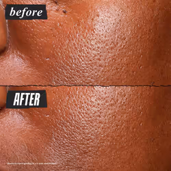 Kiehl's Ultra Pure High-Potency 5.0% Niacinamide Serum  Concentrated Face Serum for Oily Skin  Reduces Excess Oil and Shine  Helps Minimize Imperfecti