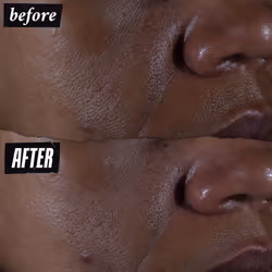 Ultra Pure High-Potency 9.8% Glycolic Acid Serum, Concentrated Exfoliating Face Serum, All Skin Types, 30 ml